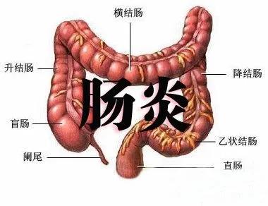 青海东大肛肠医院：直肠炎会有哪些危害？