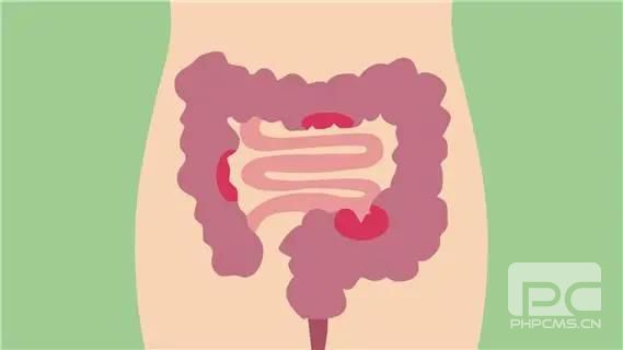 青海东大肛肠医院：慢性结肠炎的具体症状有哪些？