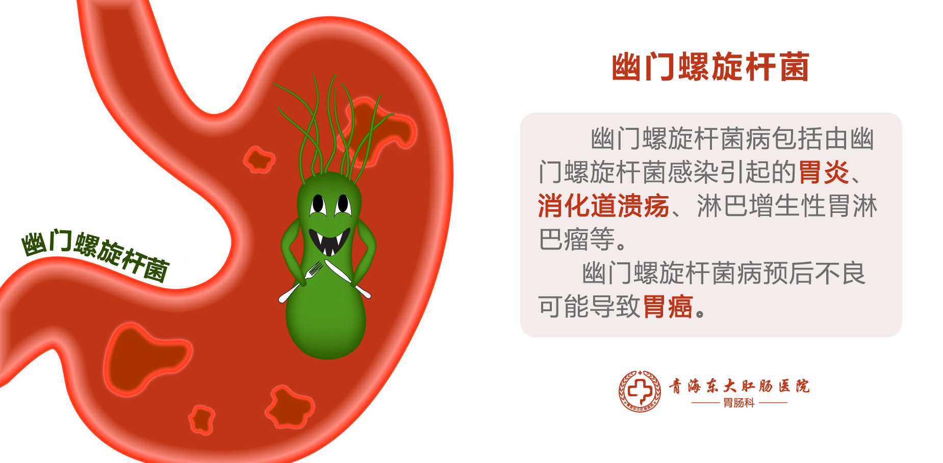 青海东大肛肠医院，幽门螺杆菌，C14呼气检测