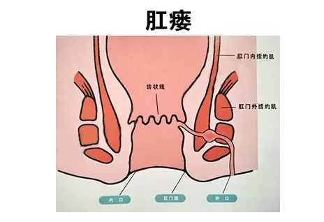 青海东大肛肠医院：带你全面解读肛痿的危害